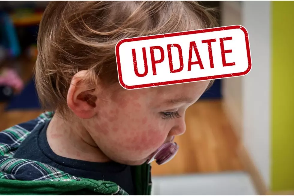 Measles Outbreak in Texas Rises To 400 Cases Across the State