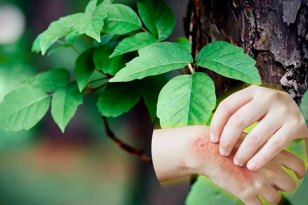Have You Tried These Texas Home Remedies for Bug Bites and Sunburns?